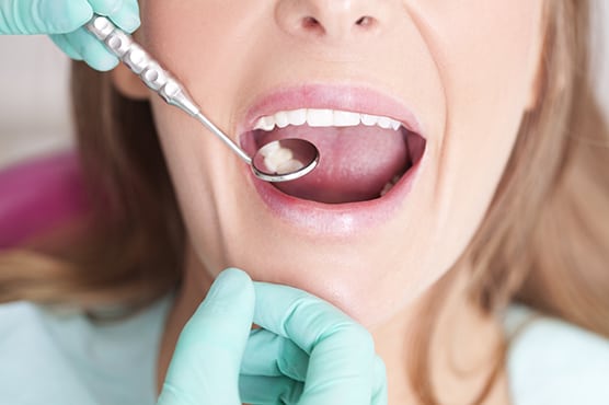 dentist working in patients mouth in dental office for single visit crowns
